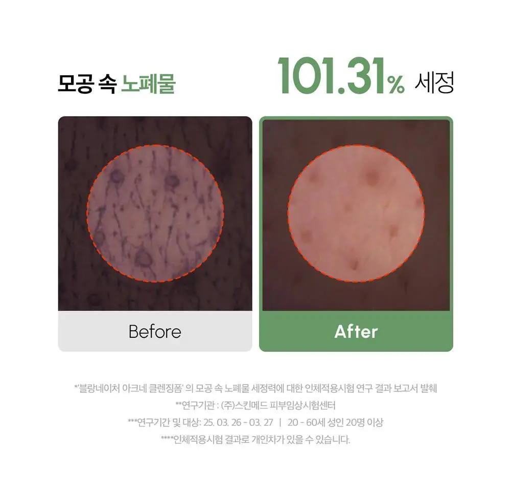 [여드름 기능성/피지케어] 블랑네이처 아크네 클렌징 폼 단품/기획 상세페이지 21